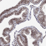 XPC Antibody in Immunohistochemistry (Paraffin) (IHC (P))