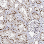 XPC Antibody in Immunohistochemistry (Paraffin) (IHC (P))