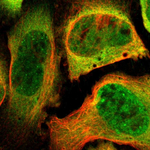 PSMC1 Polyclonal Antibody