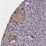 PSMC1 Antibody in Immunohistochemistry (Paraffin) (IHC (P))