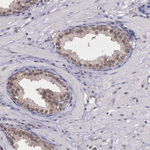 PSMC1 Antibody in Immunohistochemistry (Paraffin) (IHC (P))