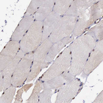 PSMC1 Antibody in Immunohistochemistry (Paraffin) (IHC (P))