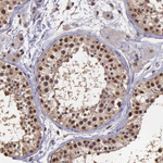 PSMC1 Antibody in Immunohistochemistry (Paraffin) (IHC (P))