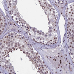 RANBP3 Antibody in Immunohistochemistry (Paraffin) (IHC (P))