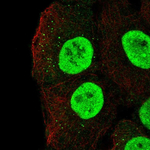 MBD1 Antibody in Immunocytochemistry (ICC/IF)