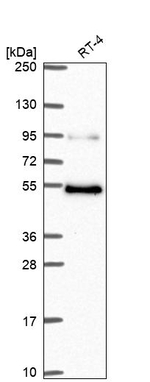 MBD1 Antibody in Western Blot (WB)