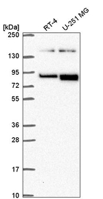 EphB2 Antibody in Western Blot (WB)