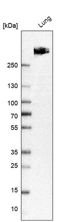 LRRK2 Antibody in Western Blot (WB)