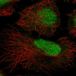 ATRIP Antibody in Immunocytochemistry (ICC/IF)