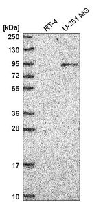 ATRIP Antibody in Western Blot (WB)