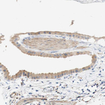 GCN2 Antibody in Immunohistochemistry (Paraffin) (IHC (P))