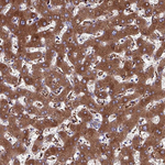 Haptoglobin Antibody in Immunohistochemistry (Paraffin) (IHC (P))