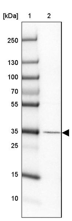 Haptoglobin Antibody in Western Blot (WB)