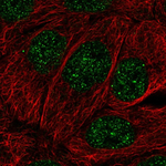 MBD2 Polyclonal Antibody