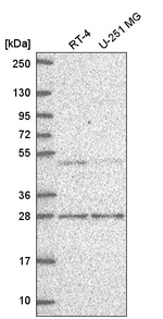 MBD2 Antibody in Western Blot (WB)