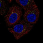 Cathepsin L Polyclonal Antibody