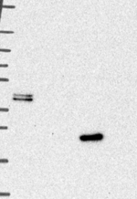 Cathepsin L Antibody in Western Blot (WB)