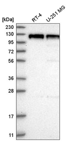 PSD93 Antibody in Western Blot (WB)