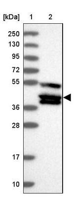 TANK Antibody in Western Blot (WB)