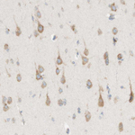 ARMET Antibody in Immunohistochemistry (Paraffin) (IHC (P))