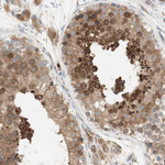 ARMET Antibody in Immunohistochemistry (Paraffin) (IHC (P))