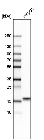 ARMET Antibody in Western Blot (WB)