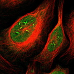 CaMKIV Polyclonal Antibody