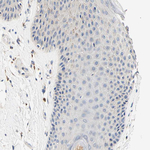 CaMKIV Antibody in Immunohistochemistry (Paraffin) (IHC (P))