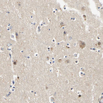 CaMKIV Antibody in Immunohistochemistry (Paraffin) (IHC (P))