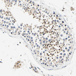 CaMKIV Antibody in Immunohistochemistry (Paraffin) (IHC (P))