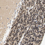 CaMKIV Antibody in Immunohistochemistry (Paraffin) (IHC (P))