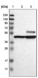 CaMKIV Antibody in Western Blot (WB)