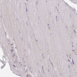 WWOX Antibody in Immunohistochemistry (Paraffin) (IHC (P))