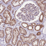WWOX Antibody in Immunohistochemistry (Paraffin) (IHC (P))