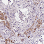 WWOX Antibody in Immunohistochemistry (Paraffin) (IHC (P))