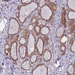 WWOX Antibody in Immunohistochemistry (Paraffin) (IHC (P))
