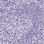 ITIH2 Antibody in Immunohistochemistry (Paraffin) (IHC (P))