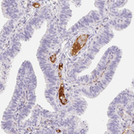 ITIH2 Antibody in Immunohistochemistry (Paraffin) (IHC (P))