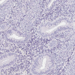 ITIH2 Antibody in Immunohistochemistry (Paraffin) (IHC (P))