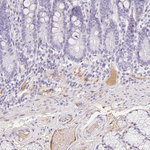 ITIH2 Antibody in Immunohistochemistry (Paraffin) (IHC (P))