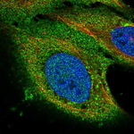Progestin Receptor beta Polyclonal Antibody