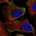 GPR133 Antibody in Immunocytochemistry (ICC/IF)