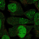 ASK Polyclonal Antibody