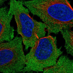 FZD4 Polyclonal Antibody
