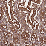 PRMT7 Antibody in Immunohistochemistry (Paraffin) (IHC (P))