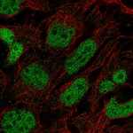 PRDM16 Polyclonal Antibody
