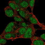 PRDM16 Polyclonal Antibody