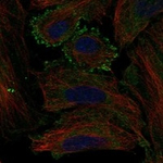 MC5R Polyclonal Antibody