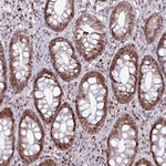 NCoR1 Antibody in Immunohistochemistry (Paraffin) (IHC (P))