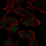SOX18 Polyclonal Antibody